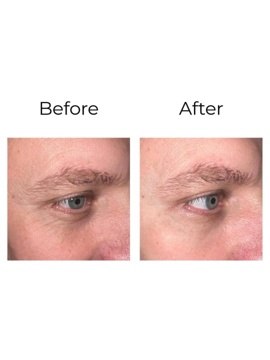 Anti-wrinkle eye contour cream “shock action effect” with LIPHASYN™ 20 ml Anti-wrinkle eye contour cream “shock action effect” with LIPHASYN™ 20 ml