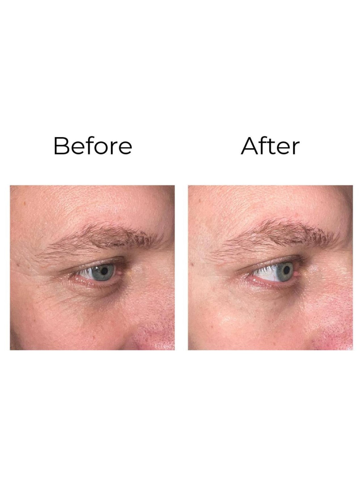 Anti-wrinkle eye contour cream “shock action effect” with LIPHASYN™ ¦ LS DIFFUSION Shop