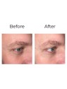 Anti-wrinkle eye contour cream “shock action effect” with LIPHASYN™ 20 ml Anti-wrinkle eye contour cream “shock action effect” with LIPHASYN™ 20 ml