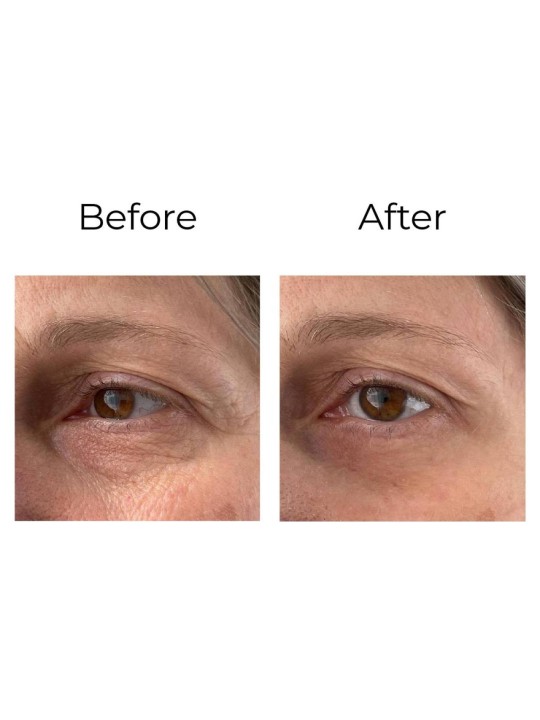 Anti-wrinkle eye contour cream “shock action effect” with LIPHASYN™ ¦ LS DIFFUSION Shop