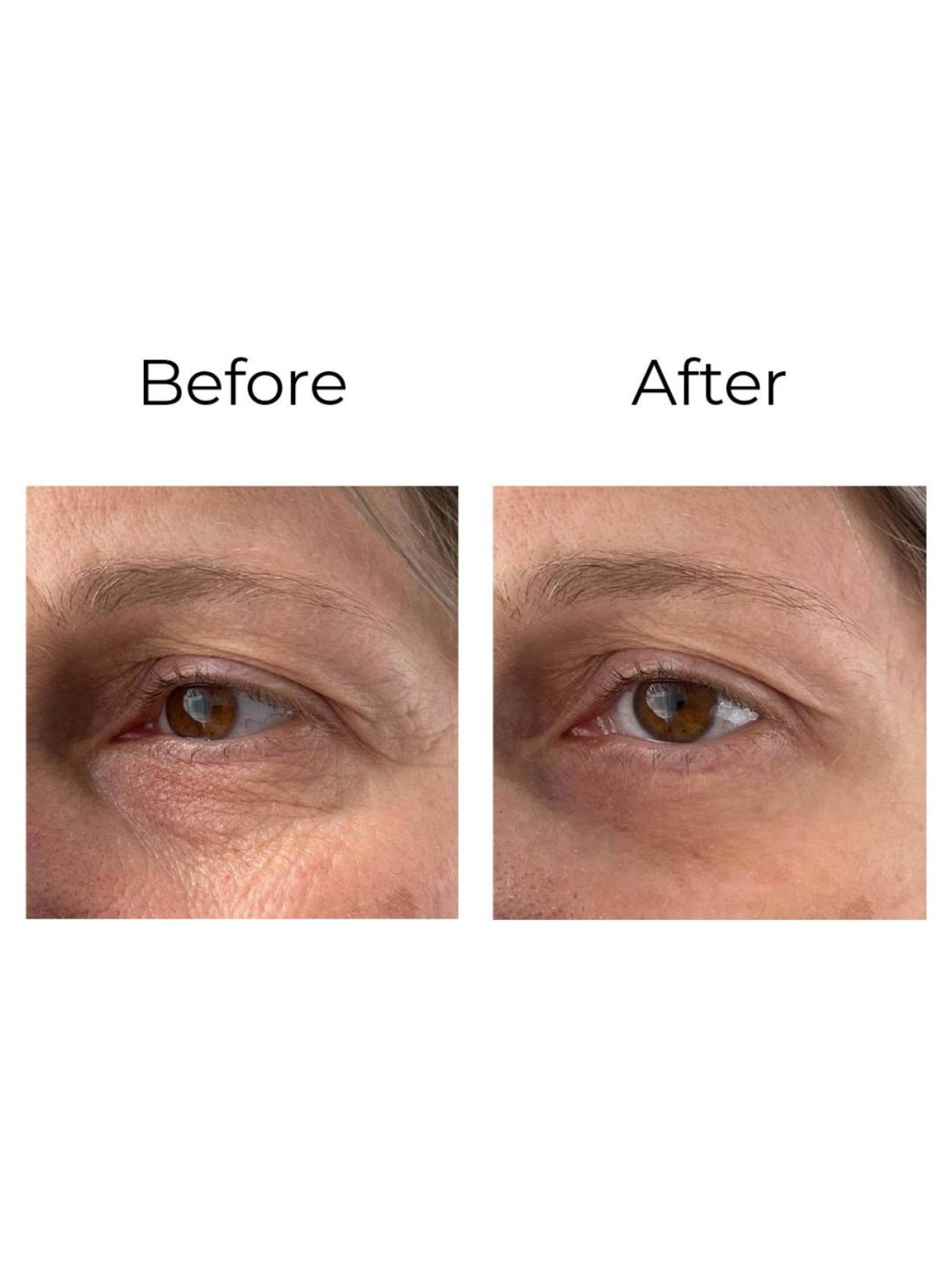 Crème contour des yeux anti-rides « shock action effect » avec LIPHASYN™ 20 ml