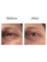 Anti-wrinkle eye contour cream “shock action effect” with LIPHASYN™ 20 ml Anti-wrinkle eye contour cream “shock action effect” with LIPHASYN™ 20 ml