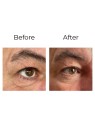 Anti-wrinkle eye contour cream “shock action effect” with LIPHASYN™ 20 ml Anti-wrinkle eye contour cream “shock action effect” with LIPHASYN™ 20 ml